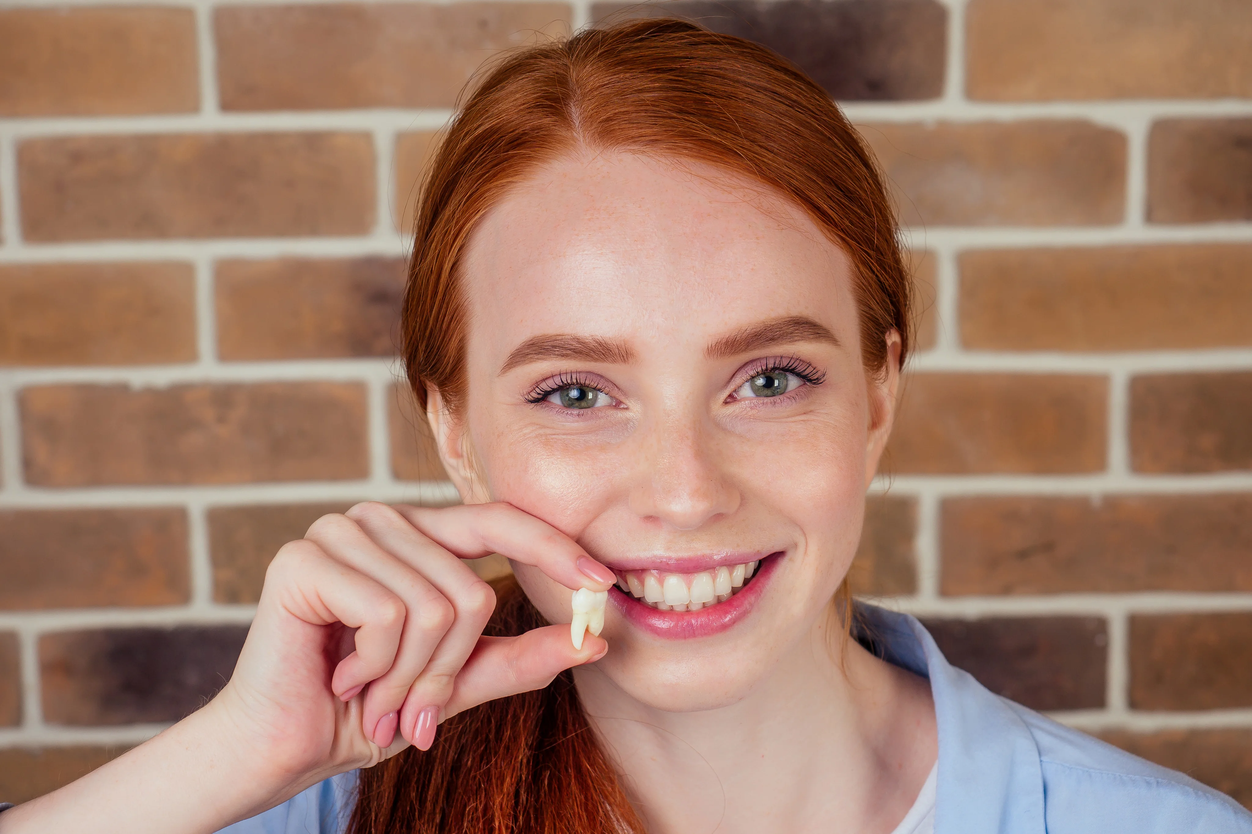 Wisdom Teeth Removal